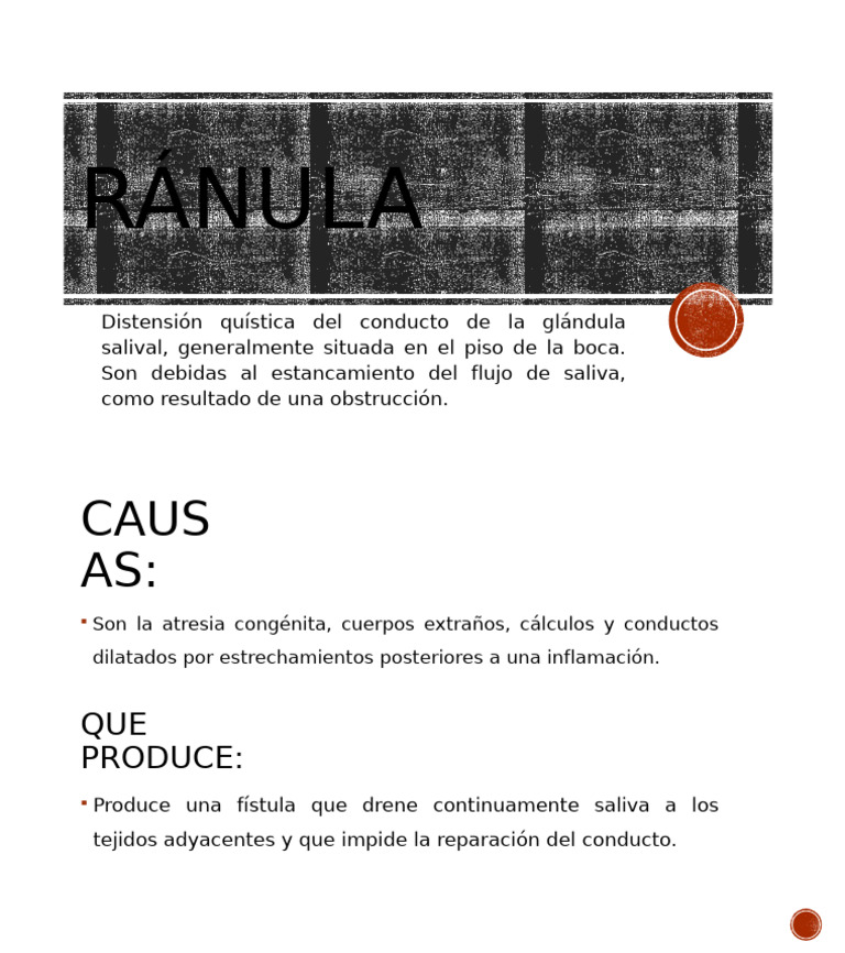 RÁNULA | PDF