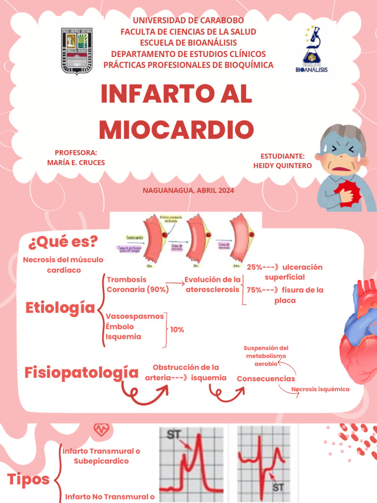 Infarto al Miocardio: Diagnóstico y Causas | PDF | Infarto de miocardio ...