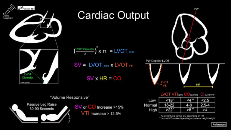 Cardiac Out Put | PDF