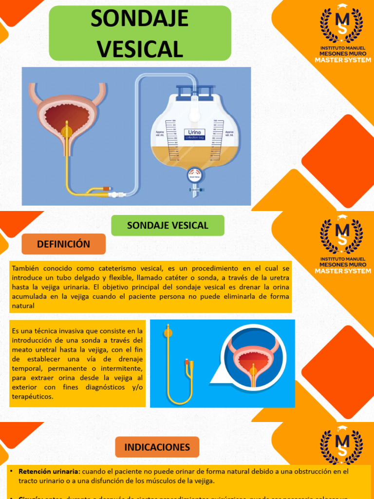 Sonda Vesical | PDF | Especialidades Medicas | Urología