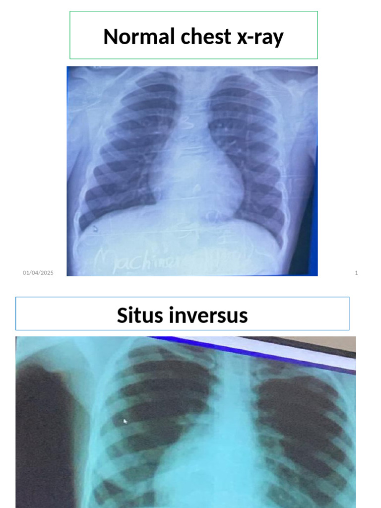 Radiology Imaging Quiz with Answers | PDF | Diseases And Disorders ...