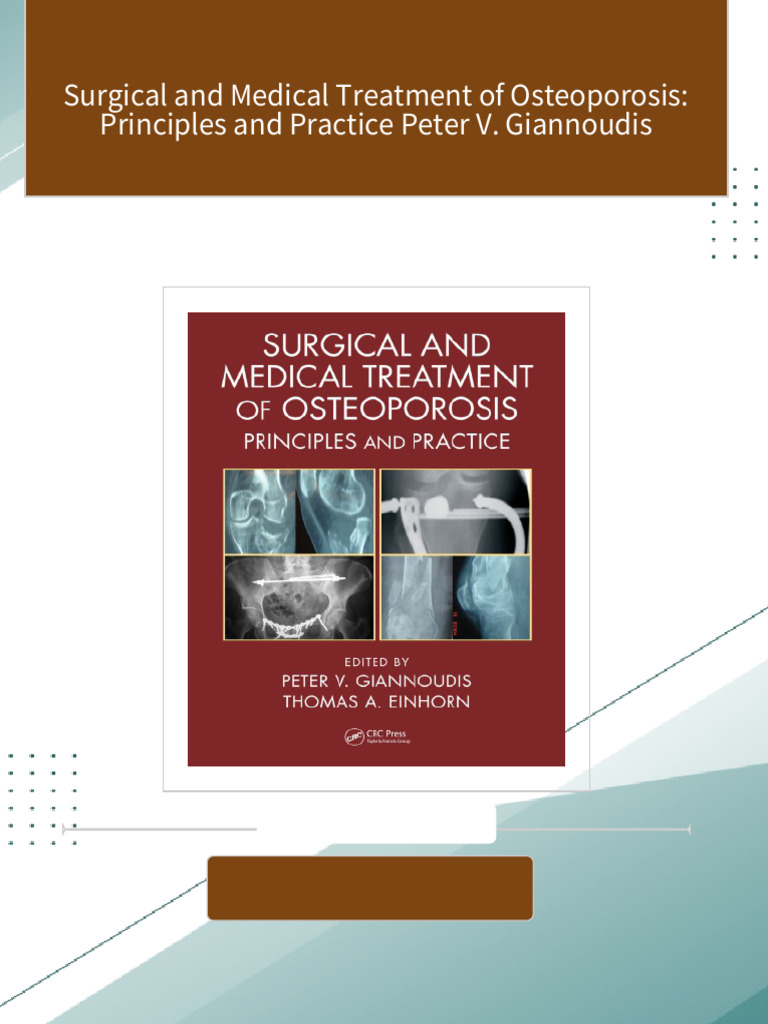 Full Download Surgical and Medical Treatment of Osteoporosis ...