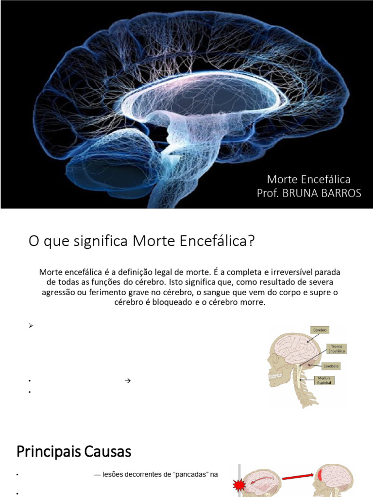 Morte Encefálica e Aneurismas Cerebrais | PDF | Morte | Especialidades ...