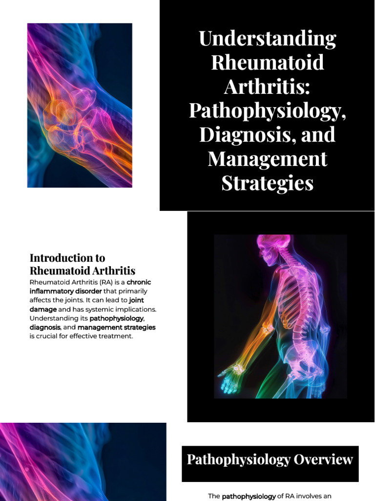 Rheumatoid Arthritis: Diagnosis & Management | PDF | Rheumatoid ...