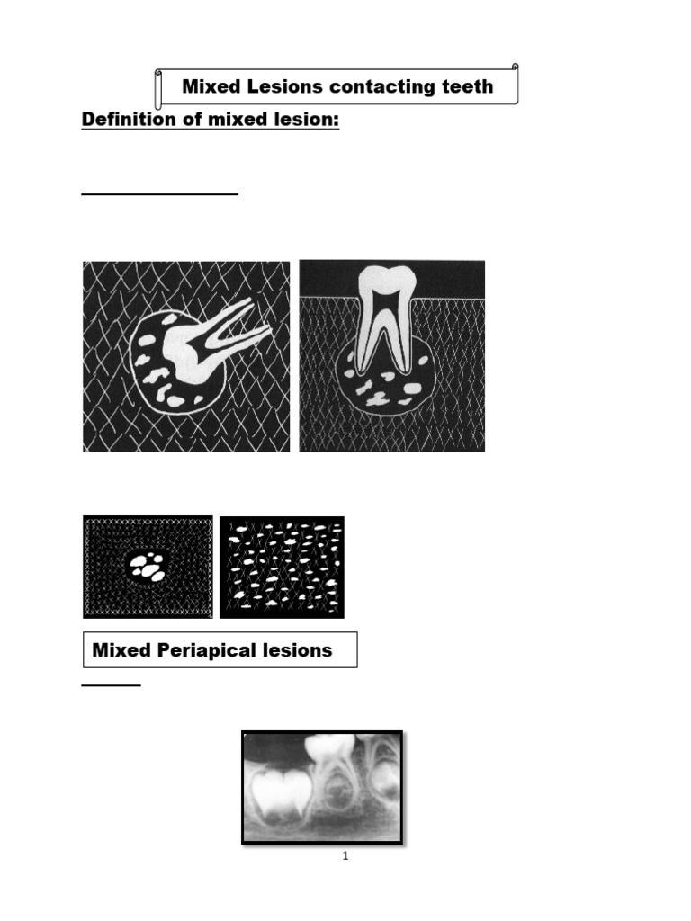 Mixed Lesions Contacting Teeth Final | PDF | Dental Anatomy | Tooth