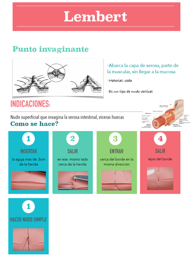 Técnicas de sutura Lembert | PDF