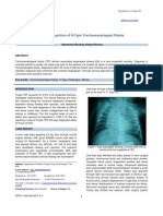 Early Recognition of H-Type Tracheoesophageal Fistula