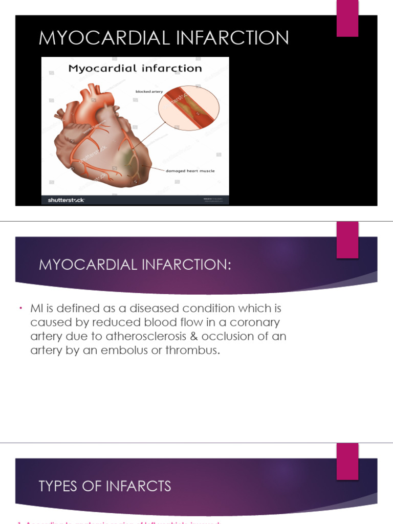 Myocardialinfarction 200407095333 | PDF | Myocardial Infarction ...