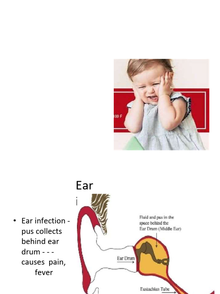 Imci 3 Ear Problem | PDF