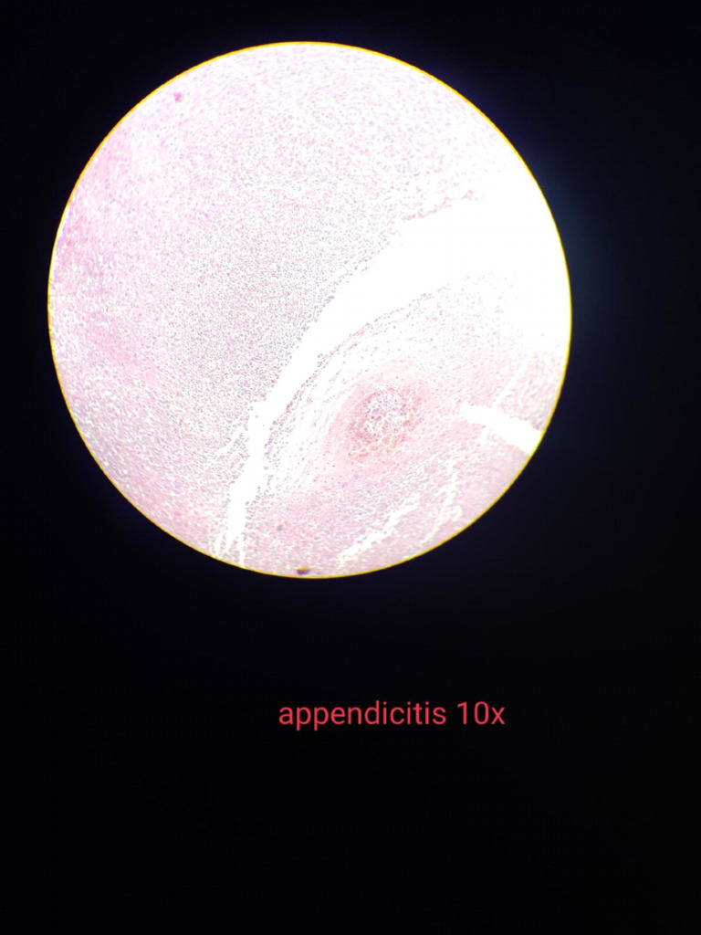 Pathology Slides | PDF
