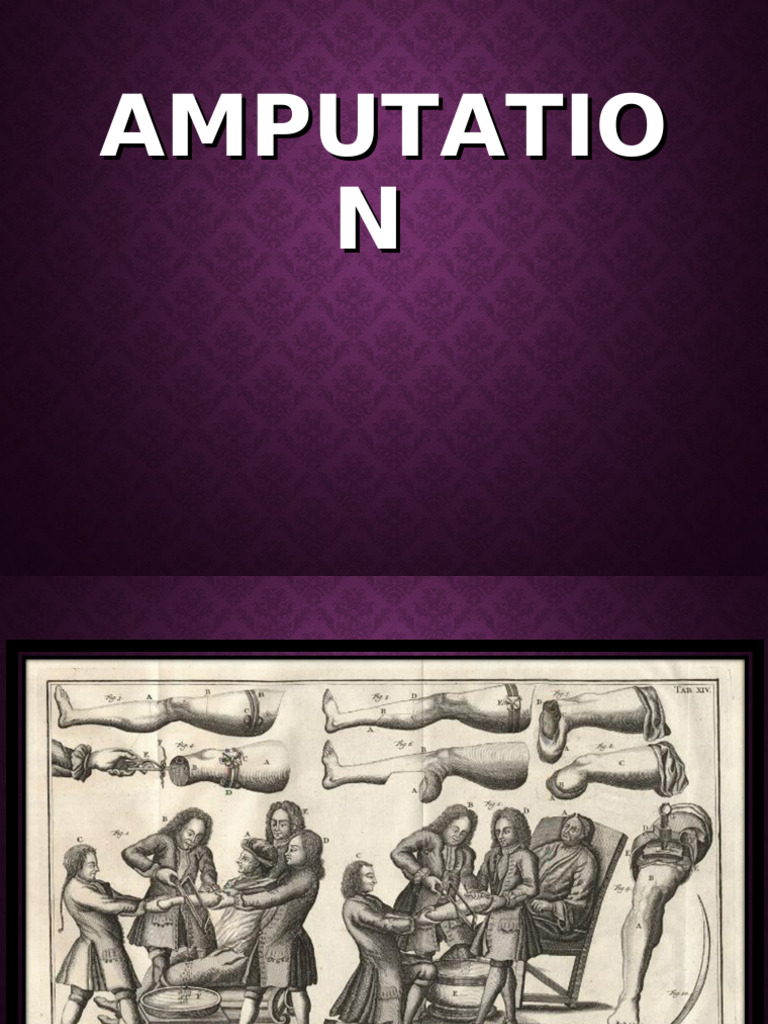 Understanding Amputation Causes and Care | PDF | Amputation | Pain