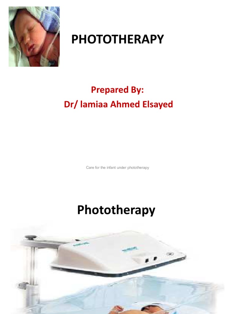 Care for the Child Under Photo Therapy Infants Breastfeeding