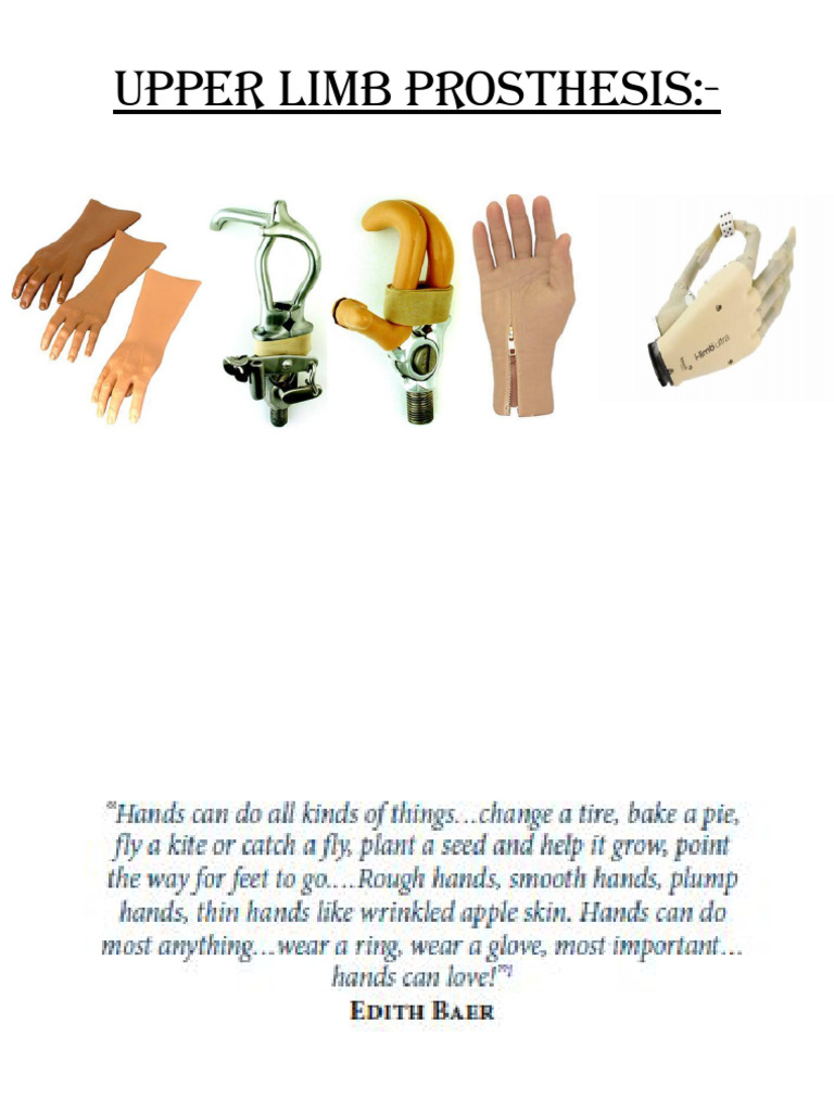 Overview of Upper Limb Prostheses | PDF | Prosthesis | Amputation