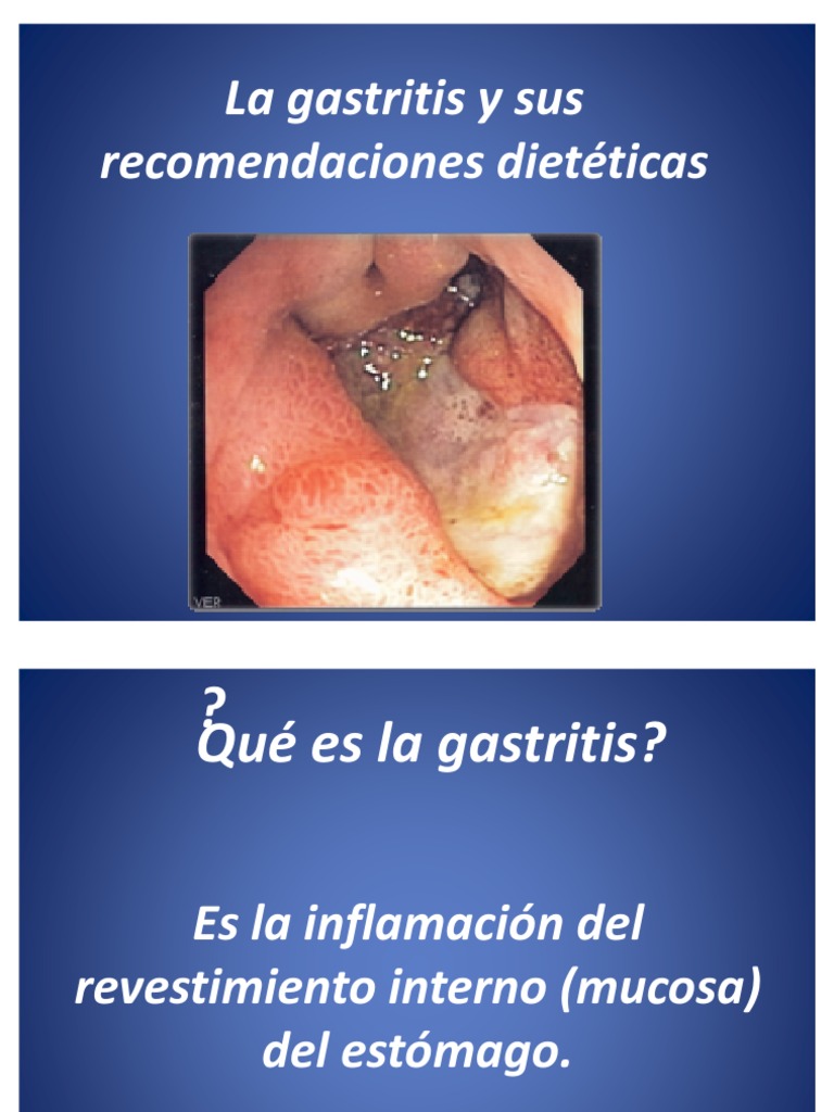 La gastritis y sus dietéticas