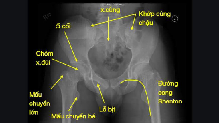 KH P Háng | PDF