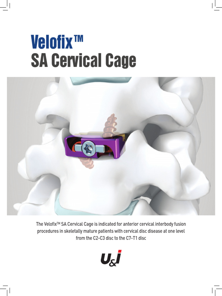 Velofix SA Cervical Cage Overview | PDF | Vertebra