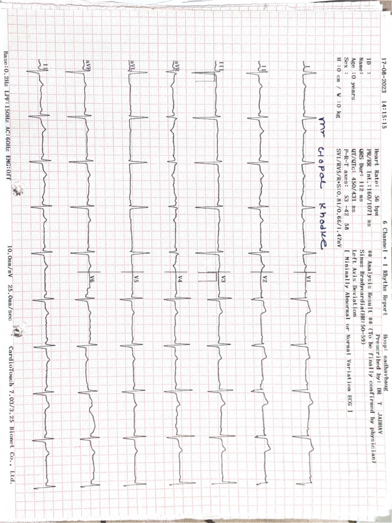 ECG Daily Compressed | PDF