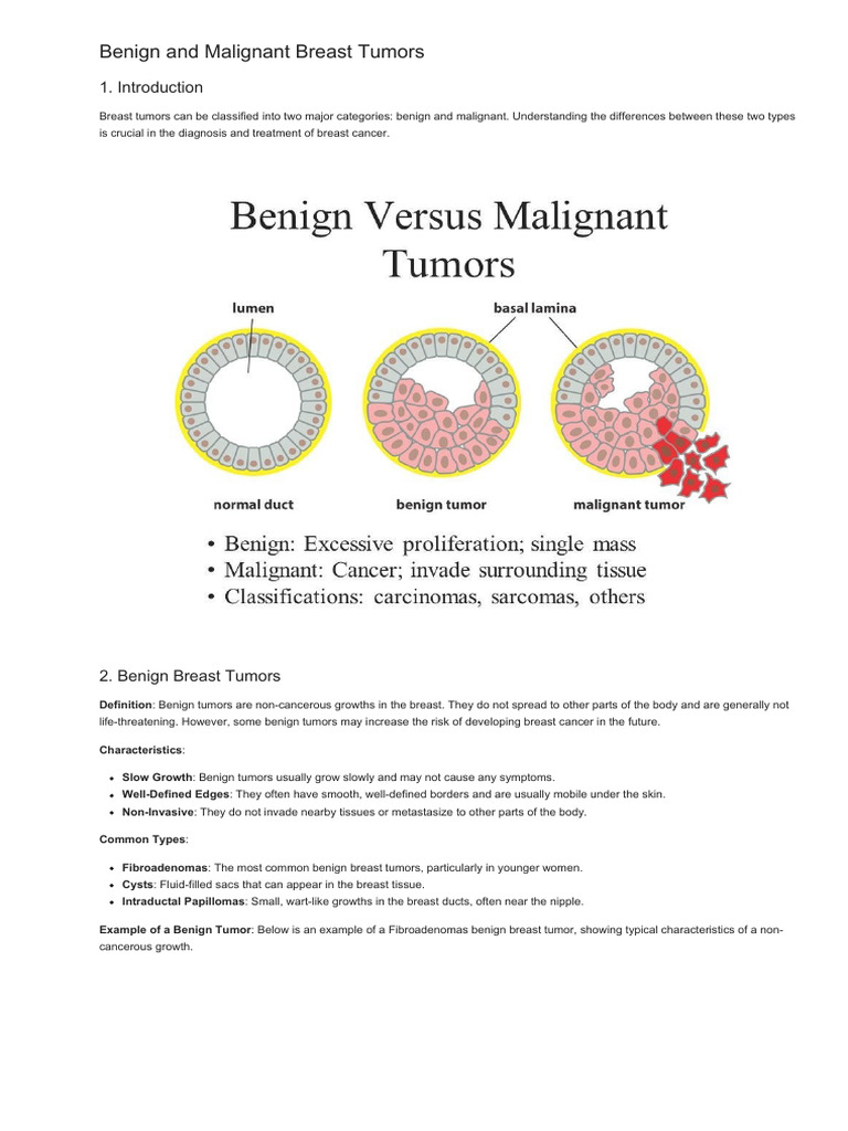Breast_Cancer_1725709979 | PDF | Benign Tumor | Breast Cancer
