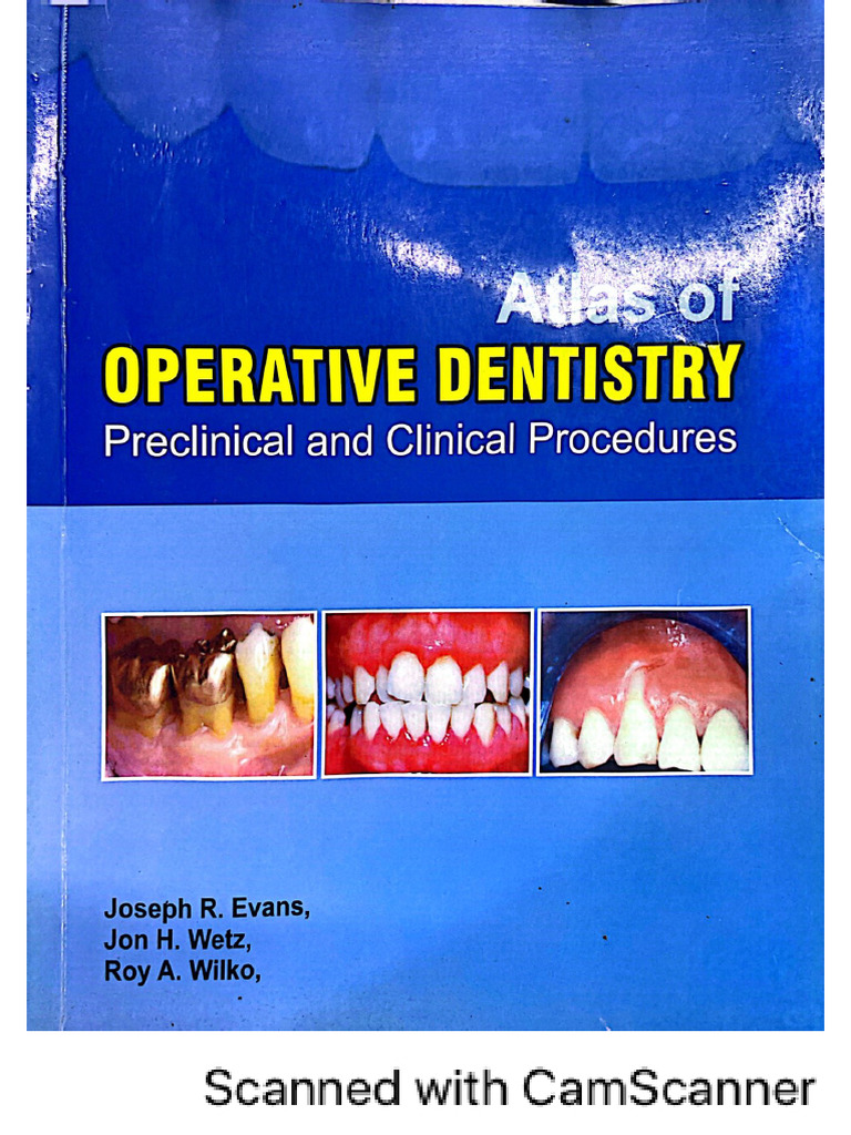Atlas of Operative Dentistry by Evans | PDF