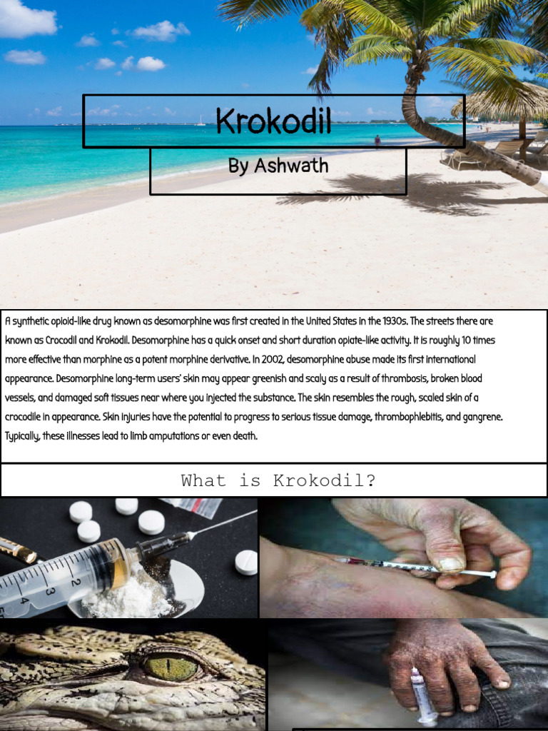 What is Krokodil_ | PDF | Medical Specialties | Clinical Medicine