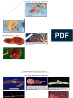 Placental Abnormalities Poster