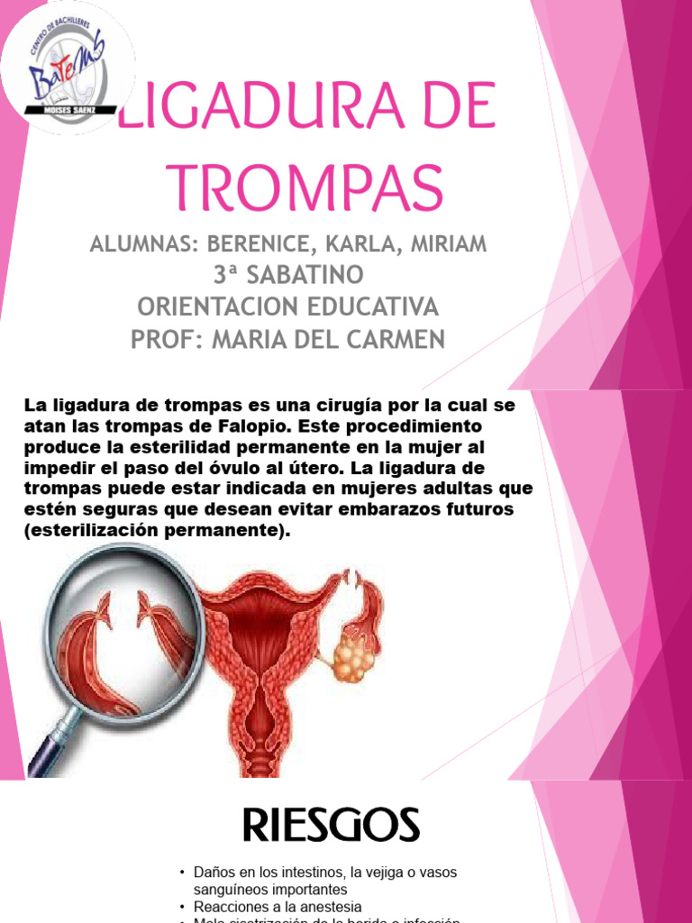 Ventajas y desventajas de la ligadura de trompas | PDF