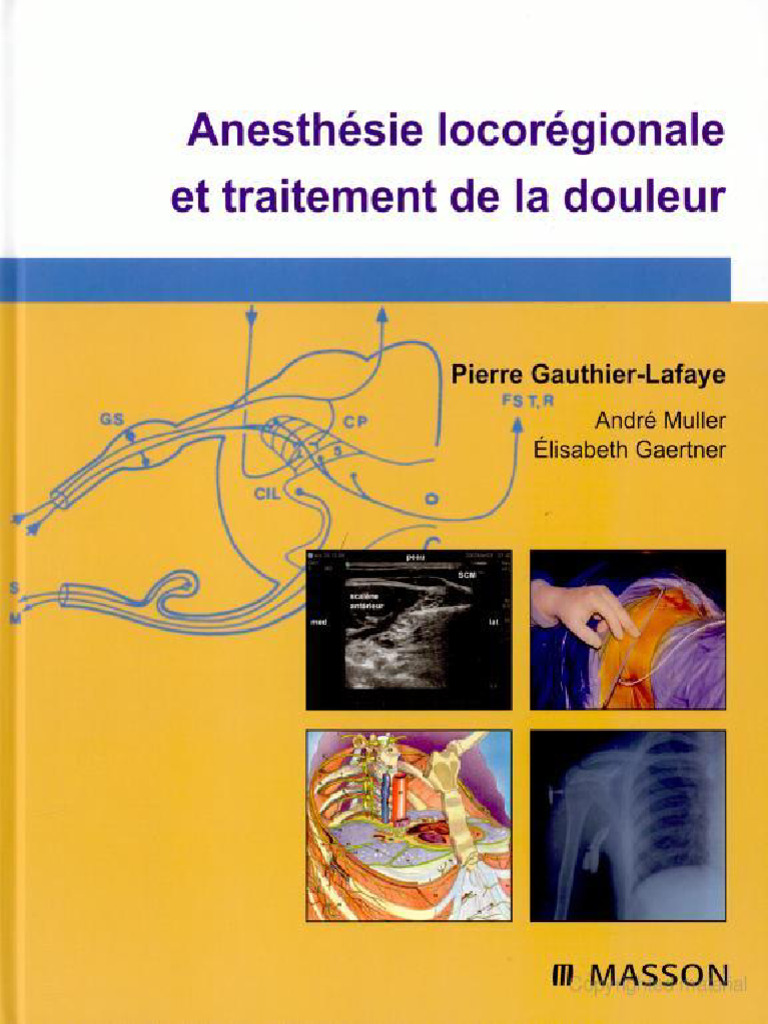 Anesthésie LocoRégionale Et Traitement de La Douleur PDF — free download