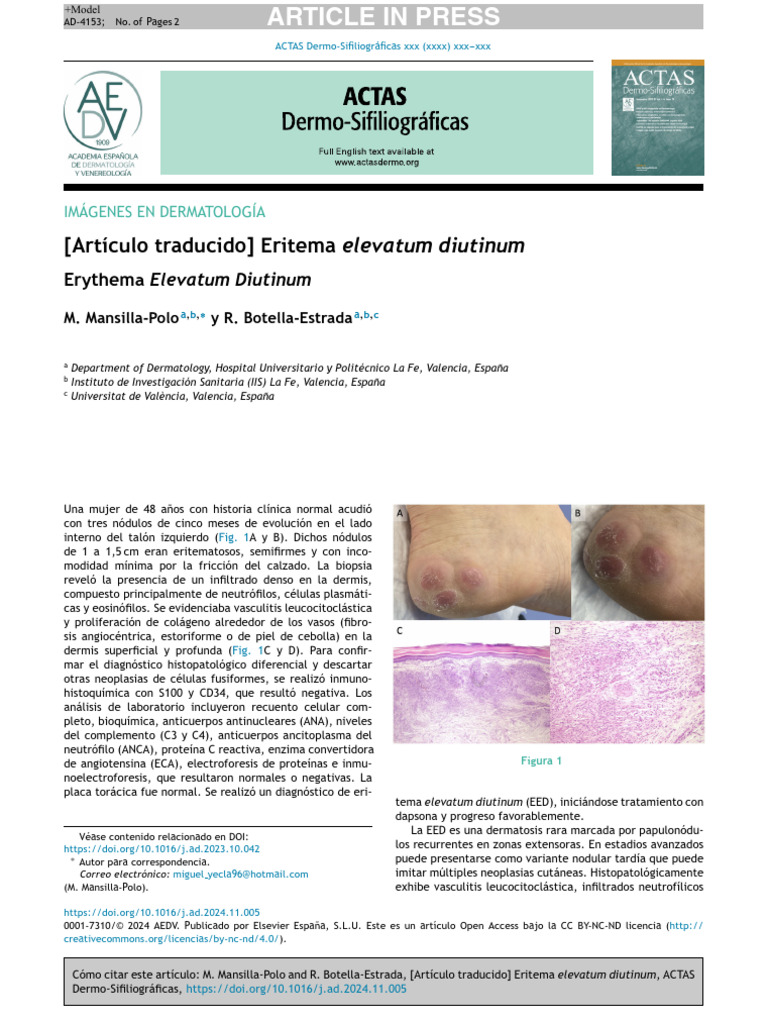 Eritema Elevatum Diutinum: Diagnóstico y Tratamiento | PDF ...