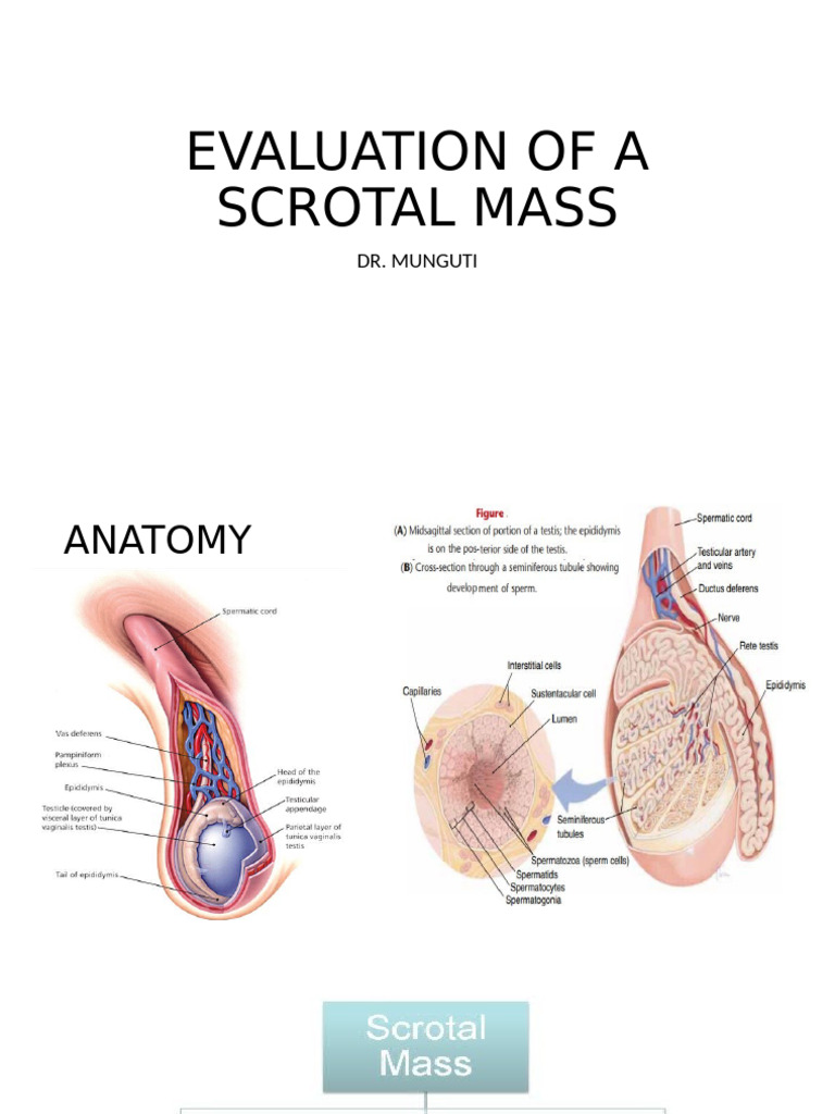 Evaluation of A Scrotal Mass | PDF | Testicle | Diseases And Disorders