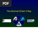 Pediatric Chest X-ray Interpretation Guide | PDF | Aorta | Thorax