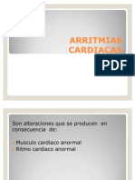 Arritmias Cardiacas