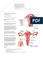 Fibroids Spanish