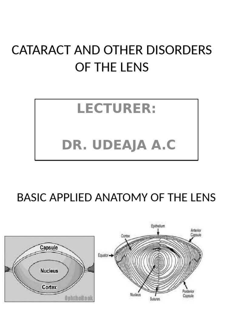Cataract and Other Disorders of the Lens | PDF | Cataract | Clinical ...