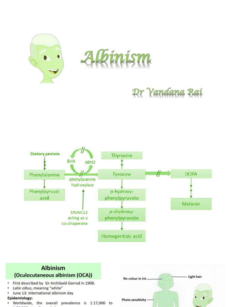 Albinism | PDF
