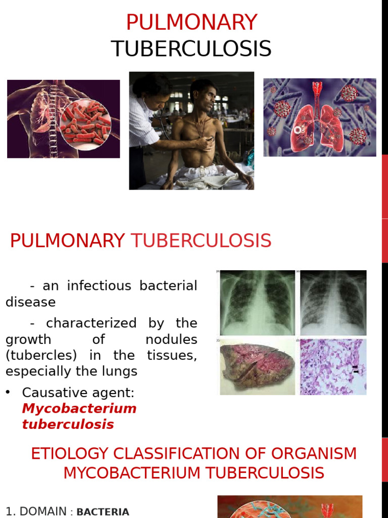Pulmonary TB: A Medical Overview | PDF | Tuberculosis | Public Health