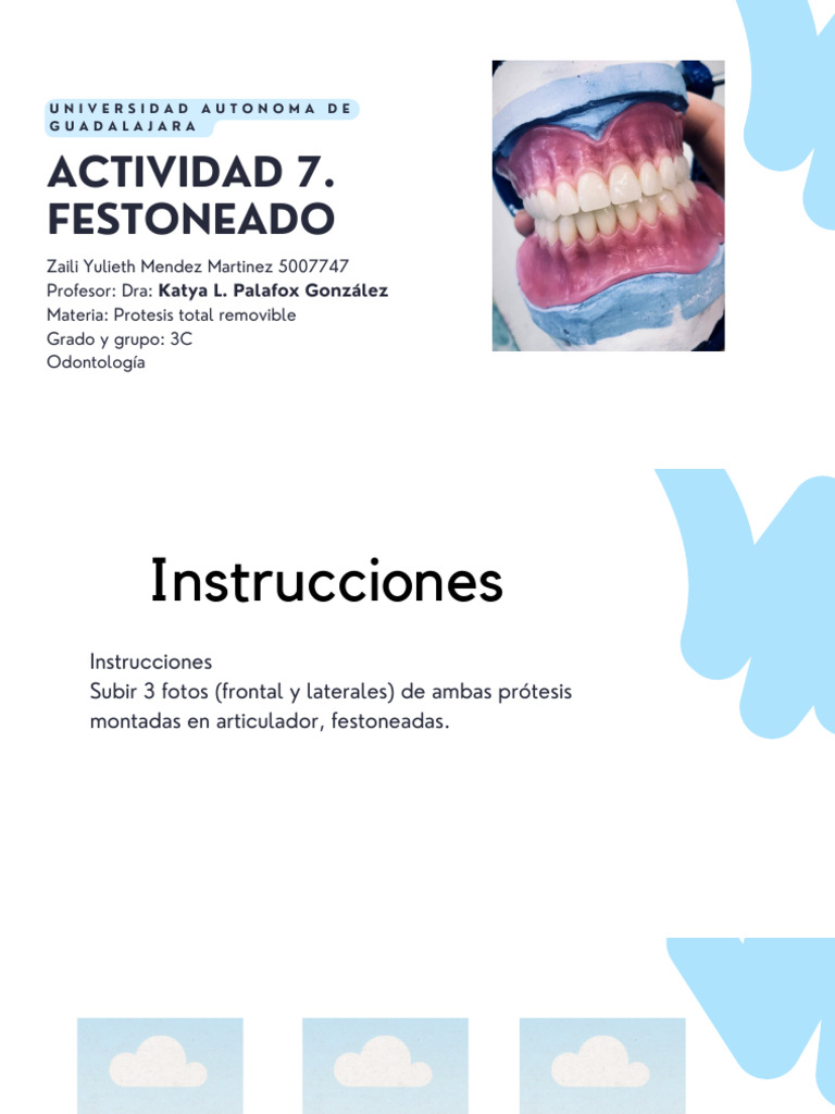 Fotos de Prótesis Festoneadas en Articulador | PDF