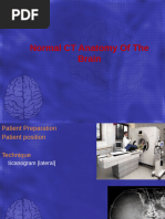 CT Brain Anatomy Overview Guide | PDF | Skull | Skeletal System