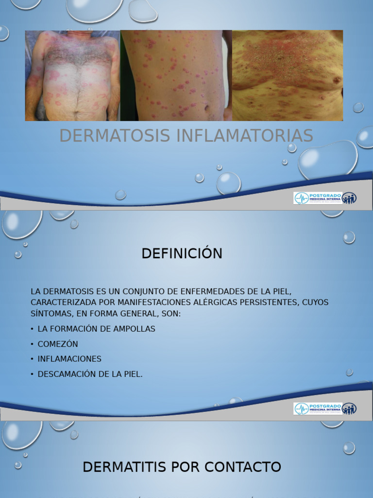 Dermatosis Inflamatorias y Pruriginosas | PDF | Alergia | Dermatología