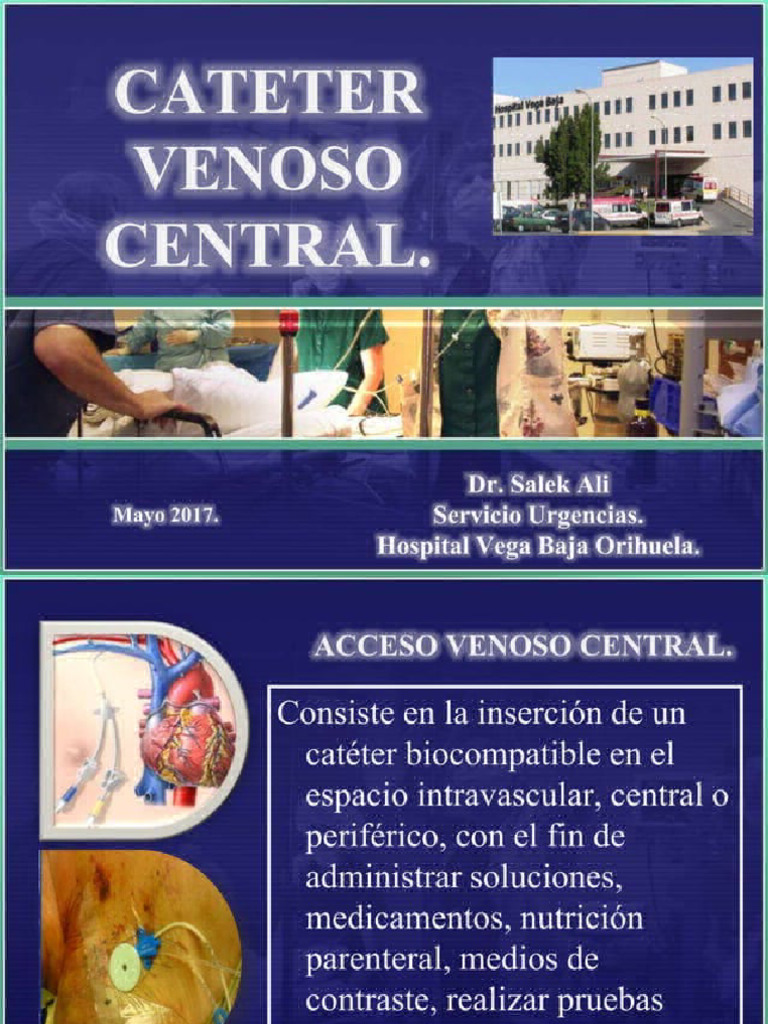 CVC Cat ter Venoso Central 20240502 171144 PDF