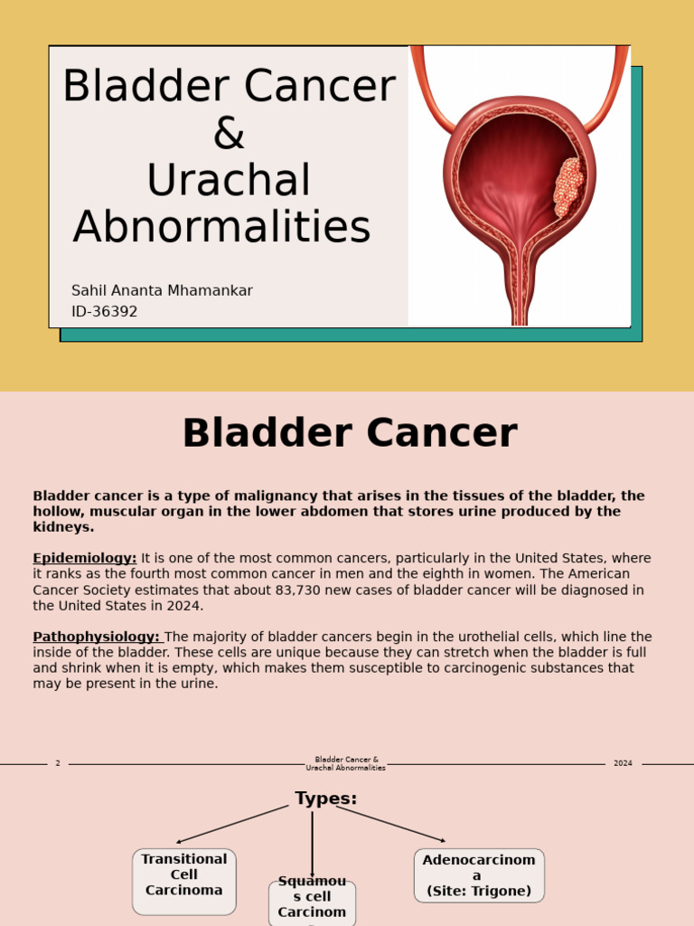 Urinary Bladder Cancer and Urachal Abnormalities | PDF | Clinical ...
