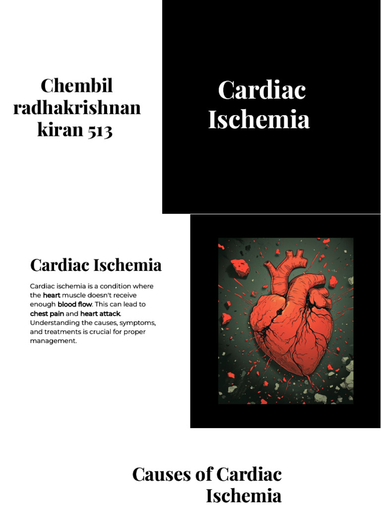 Cardiac Ischemia Pdf Coronary Artery Disease Heart