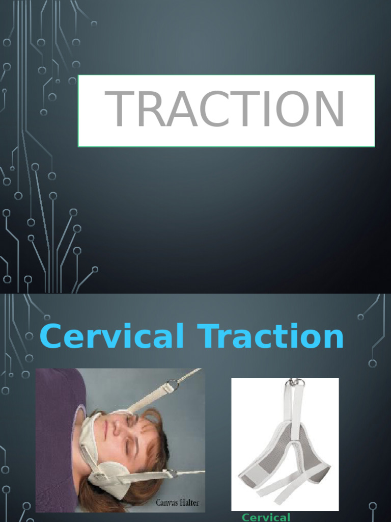 Cervical Traction Techniques Explained | PDF | Vertebral Column | Pelvis