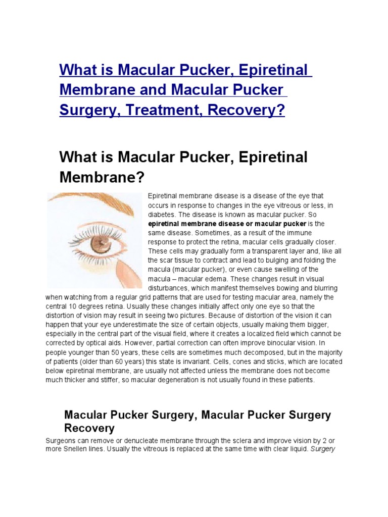 Epiretinal Membrane Surgery Recovery
