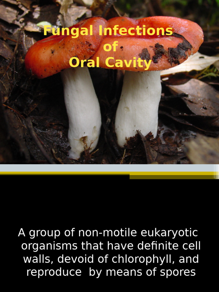Oral Candidiasis and Fungal Infections | PDF | Medical Specialties ...