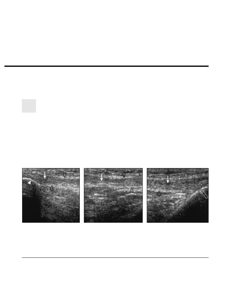 Carr Et Al 2012 Sonography of The Patellar Tendon and Adjacent ...