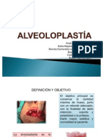 Alveoloplastia Final