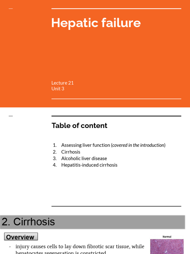 Lecture 21.2 - Hepatic Failure | PDF | Cirrhosis | Hepatitis