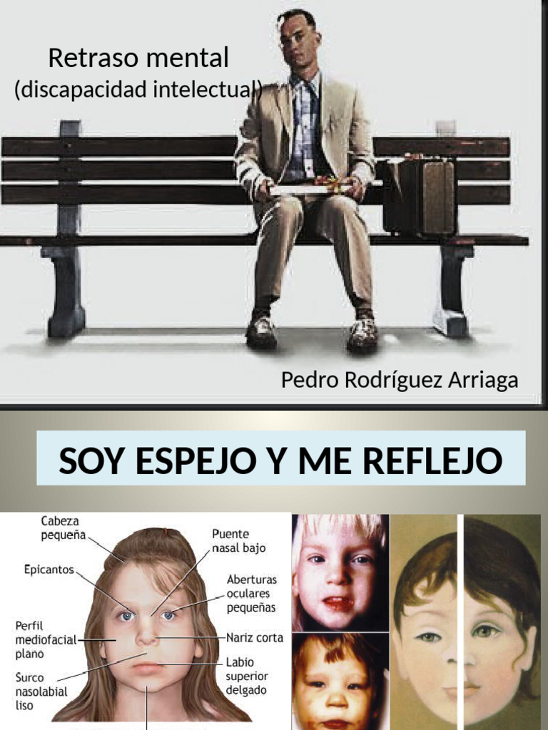 Comprendiendo el Retraso Mental | PDF | Discapacidad intelectual ...