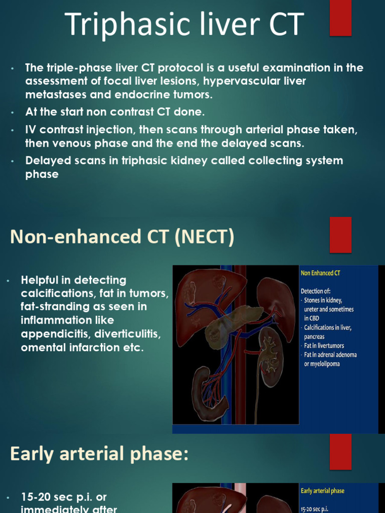 Triphasic CT Protocol for Liver Imaging | PDF | Liver | Cirrhosis