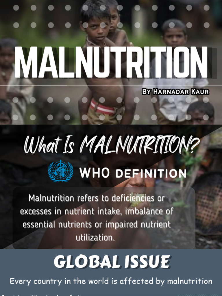 Malnutrition Ppt Pdf Malnutrition Foods